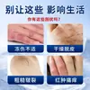 Crema Antibacteriana Flor Roja Xianhuaitang Crema para Grietas y Rozaduras para Manos y Pies Agrietados, Sequedad, Enrojecimiento e Hinchazón, Crema de Cuidado Hidratante y Nutritiva Venta al por Mayor