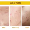 Amazon Venta Caliente Transfronteriza Parches para Acné Cubierta de Hidrocoloide Impermeable Portátil Estrellas de Colores Irregulares 40 Piezas Cubierta para Acné