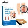 Shopee Aliexpress Adesivo para Veias Patch para Varizes Uso Externo Adesivo Preto Atacado Fisioterapia Cuidados com a Saúde