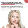 Ouhoe Cuidado Facial Parche para Acné Limpieza Suave Piel con Acné Suave y Lisa Múltiples Formas Parche para Acné Portátil