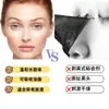 Adesivos Nasais Hidrocoloides Transfronteiriços, Adesivos para Acne de Grande Área, Adesivos Retangulares para Acne, Adesivos Nasais Hidrocoloides Descartáveis