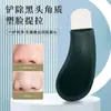Herramienta Manual Extractor de Puntos Negros, Efectiva para Eliminar Puntos Negros y Acné, Raspador Facial Limpiador de Poros, Práctico, Mayoreo, Envío Gratis