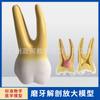 Modelo de dente humano Molar canino incisivo 2 partes anatomia estrutura dentária ampliada modelo de espécime de dente grande