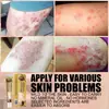 Ventas Exclusivas Transfronterizas de Sol Lora en Aliexpress y Amazon, Más Vendido en Stock Cuero de Piel de Vaca Tigre (Amarillo) Sol043