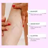 Ximonth Patch para Cuidados com as Pernas Hidratante Suave Cuidado Confortável para as Pernas Patch de Cuidado com Massagem Relaxante