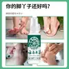 Spray Herbal de Yunnan Veneno de Lobo para Pie de Atleta, Mal Olor de Pies, Sudoración Excesiva, Piel Descamada, Pies Doloridos, Spray Anti-Picazón, Tratamiento para Hongos, Cuidado de los Pies
