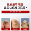 Crema para Uñas Estilo Tiktok para Uñas Grises, Cuidado Iluminador de Uñas, Cuidado de Pies, Crema para Uñas de Manos, Fuente de Uñas Gruesas, Venta al por Mayor de Fabricante, Dropshipping