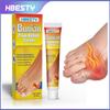 Crema para masajes de juanetes transfronteriza Becsty, cuidado herbal de las articulaciones, gel de compresa fría, ungüento articular penetrante en los huesos y colaterales