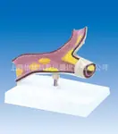 病态血管模型病理模型