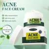 Creme para Acne com Ácido Salicílico Transfronteiriço, Creme Facial para Acne, Suaviza Marcas de Acne, Creme para Acne, Creme de Controle de Oleosidade, Inglês Completo