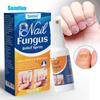 Sumifun Comércio Exterior Transfronteiriço Spray para Cuidados com as Unhas Solução Reparadora para Unhas dos Pés Desinfetante Solução de Potássio para Brilho K50010