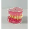 Modelo Dental Escovação Oral Prótese Dentária Boca Inteira Dental Removível Gengiva Macia Transparente Resina para Implante Preparo Dentário Molde de Dente