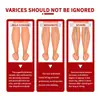 Crema para el Cuidado de las Venas South Moon Masajeador de Piernas Alivia el Dolor y Repara las Várices Crema para el Cuidado Corporal