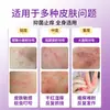 Crema Antibacteriana Transdérmica Flor Morada Dijing para Piel Seca y Descamada, Anti-Picazón, Crema de Uso Externo para Todo el Cuerpo, Producto Genuino de la Tienda Oficial Principal