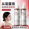 Spray Corporal Anti-Acné Han Lun Elimina el Acné en el Frente, Pecho y Espalda, Refrescante, Hidratante, Reparador y Rejuvenecedor Spray para Acné de Espalda