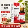 Líquido Herbal para Eliminar y Limpiar Callos, Solución Herbal para el Cuidado de Pies, Líquido para el Cuidado de Callos en Manos y Pies, Solución para el Cuidado de Uñas Grises en Dedos de Manos y Pies, Al por Mayor en Stock