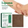 Parche Cuidado Nudo Graso SouthMoon, Parche Cuidado Corporal Esencia de Jengibre, Comercio Exterior Transfronterizo