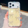 Estilo Luxo Leve 13 Laço Galvanizado 14 Estrelas de Diamante Brilhantes 15 Pontos de Glitter Imd Adequado para Telefone Apple 16Promax
