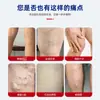 Ungüento para Venas para Congestión de Vasos Sanguíneos en las Piernas, Ungüento de Salud para Alivio de Venas al por Mayor, Ungüento para Venas Varicosas