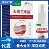 Venta al por mayor del fabricante Zhengtai Lin Líquido para picazón 30 ml Envío directo