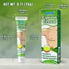 Sumifun Amazon Transfronterizo Parche Crema para Cuidado de la Grasa Cuidado Externo de la Piel Crema Parche de Grasa Venta al por Mayor Otros