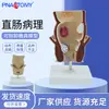Intestinos Humanos, Hemorroides, Enfermedad se Convierte en Modelo de Disección, Colonización, Intestinos Anales, Ano, Músculo Esfínter, Muestras de Enseñanza