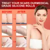 Folhas de Silicone Popular Transfronteiriças 1,5m Acalmam a Pele e Suavizam Cicatrizes Fita de Silicone para Cicatrizes