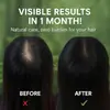 Sabonete Shampoo Óleo de Folha de Platycladus Osmanthus Controle de Oleosidade Anticaspa Polygonum Multiflorum Cabelo Grosso Sabonete Shampoo Artesanal Sabonete Shampoo