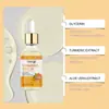Jabón Limpiador Iluminador de Cúrcuma Hoygi Limpieza Suave, Suavizante, Hidratante, Refrescante y Limpiador para la Piel del Cuerpo
