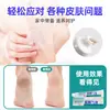 La Pomada Miao Yaotang Footang es Refrescante y Sudorosa para Pies con Picazón y Pies Más Pequeños