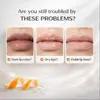 Crema Aclaradora de Labios Oscuros Transfronteriza Cuidado de Día y Noche Bálsamo Labial