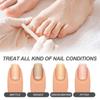 Solução para Cuidado das Unhas Oceaura Hidratante e Cuidosa com as Unhas, Hidratante e Retentora de Umidade, Solução Suave e Refrescante para Cuidado das Unhas