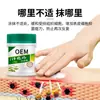Crema Personalizada para Sudoración y Hongos para Manos y Pies, Pie de Atleta, Picazón, Ampollas, Descamación, Crema Antibacteriana y Anti-Picazón, Ungüento para Masaje de Piel Puede Ser OEM