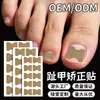 Pegatinas de Corrección de Uñas Transfronterizas del Fabricante para Uñas Encarnadas, Aliviando el Encrespamiento de las Uñas, Pegatinas de Corrección sin Pegamento, Pegatinas de Corrección de Uñas para Manicura