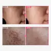 Crema Facial Arbutina 7% Ácido Tranexámico Niacinamida Hidratante y Humectante Transfronteriza