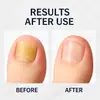 Cuidado de Uñas Transfronterizo Líquido para Uñas con Ácido Hialurónico 10ml