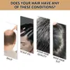 Champú Transfronterizo Que Nutre Profundamente las Raíces del Cabello, Previene la Caída del Cabello, Fortalece el Cabello, Hace el Cabello Espeso y Suave, Procesamiento OEM