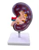 Modelo de aumento de anatomía renal modelo de enseñanza médica modelo de anatomía del riñón humano