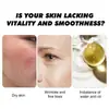 Crema Facial de Cuidado de la Piel con Veneno de Abeja Transfronteriza Calma el Enrojecimiento Mejora el Brillo y la Firmeza de la Piel