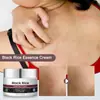 Creme Calmante para Cuidados com Extrato de Planta Transfronteiriço Hidratante, Hidratante e Suave Creme com Essência de Arroz Negro 50g