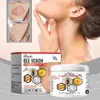 Ximonth Crema de Cuidado con Veneno de Abeja para Psoriasis Cuidado de la Piel Hidratación de la Piel Crema para el Cuidado de la Piel