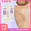Creme Facial Transfronteiriço Ximonth Cuidado com a Pele Acne Herbal Cuidado Refrescante Creme de Cuidado Suavizante e Rejuvenescedor