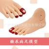 Modelo de cuidado del pie diabético pie diabetes cambios patológicos pie pie lesiones material PVC
