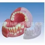 三岁乳恒牙交替解剖模型医学模型