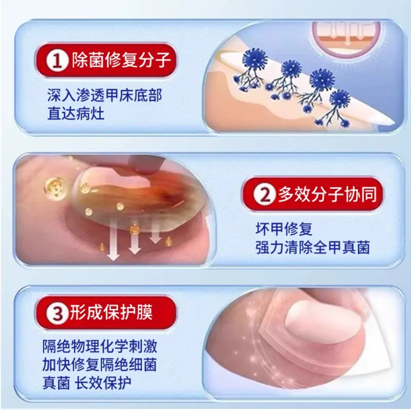 医用足部敷料-4-1