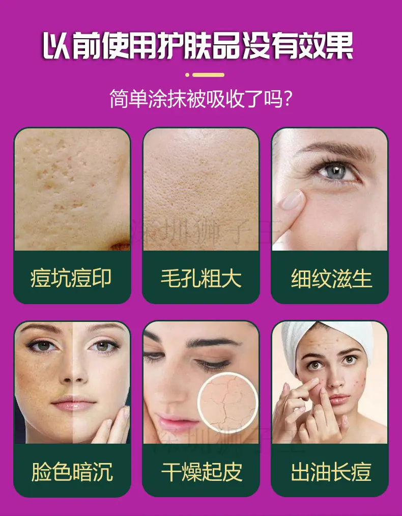 白柄紫轮-恢复的_03