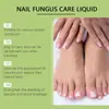 Juego para el Cuidado de Uñas de Manos y Pies Cuidado de Uñas de Pies Onicomicosis Uña Brillante Uña Suave Solución para el Cuidado de Uñas Encarnadas
