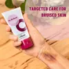 Crema para Hematomas de Comercio Exterior Crema Hidratante Crema Transfronteriza para Hematomas Mejora la Hinchazón Muscular, el Dolor y los Hematomas en Manos y Pies