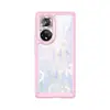 Adequado para Capa de Celular Honor 50Pro Capa de Celular Transparente de Acrílico Espacial Anti-Queda Honor 50Pro Capa Protetora