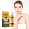 Ximonth Spray para el Cuidado de la Piel Limpiador Corporal Alisador de la Piel Spray para el Cuidado de la Piel